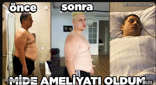 Ahmo